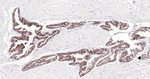 delta Catenin Antibody in Immunohistochemistry (Paraffin) (IHC (P))