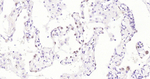 Nkx2.1 Antibody in Immunohistochemistry (Paraffin) (IHC (P))