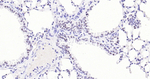 Nkx2.1 Antibody in Immunohistochemistry (Paraffin) (IHC (P))