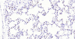 Nkx2.1 Antibody in Immunohistochemistry (Paraffin) (IHC (P))