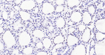 Nkx2.1 Monoclonal Antibody (5B12)