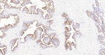 Prostate Specific Acid Phosphatase Monoclonal Antibody (3B9)