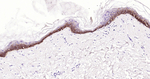 Cytokeratin 5 Antibody in Immunohistochemistry (Paraffin) (IHC (P))