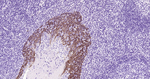 Cytokeratin 5 Antibody in Immunohistochemistry (Paraffin) (IHC (P))