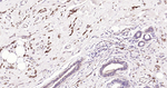 Stathmin 1 Antibody in Immunohistochemistry (Paraffin) (IHC (P))