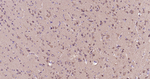 Stathmin 1 Antibody in Immunohistochemistry (Paraffin) (IHC (P))