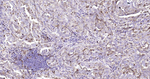 Stathmin 1 Monoclonal Antibody (14F6)