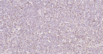 Stathmin 1 Antibody in Immunohistochemistry (Paraffin) (IHC (P))