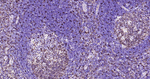 Stathmin 1 Antibody in Immunohistochemistry (Paraffin) (IHC (P))