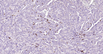 Arginase 1 Antibody in Immunohistochemistry (Paraffin) (IHC (P))