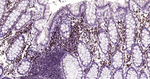 MUM1 Antibody in Immunohistochemistry (Paraffin) (IHC (P))