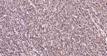 MUM1 Antibody in Immunohistochemistry (Paraffin) (IHC (P))