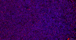 MUM1 Monoclonal Antibody (9H6)