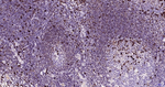 MUM1 Antibody in Immunohistochemistry (Paraffin) (IHC (P))