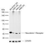 TACR1 Recombinant Rabbit Monoclonal Antibody (12C15)
