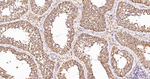AIF Antibody in Immunohistochemistry (Paraffin) (IHC (P))