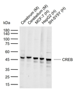 CREB Recombinant Rabbit Monoclonal Antibody (14D4)