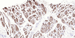 Myoglobin Antibody in Immunohistochemistry (Paraffin) (IHC (P))