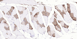 Myoglobin Monoclonal Antibody (3A7)