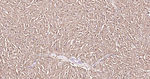 Myoglobin Antibody in Immunohistochemistry (Paraffin) (IHC (P))