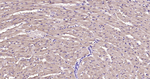 Myoglobin Antibody in Immunohistochemistry (Paraffin) (IHC (P))