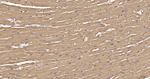 Myoglobin Antibody in Immunohistochemistry (Paraffin) (IHC (P))