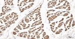 Myoglobin Antibody in Immunohistochemistry (Paraffin) (IHC (P))