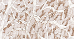 Myoglobin Antibody in Immunohistochemistry (Paraffin) (IHC (P))