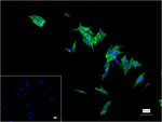 Procalcitonin Monoclonal Antibody (5C4)