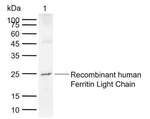 Ferritin Light Chain Monoclonal Antibody (10E3)