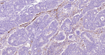 CD105 Antibody in Immunohistochemistry (Paraffin) (IHC (P))
