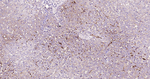 CD105 Antibody in Immunohistochemistry (Paraffin) (IHC (P))