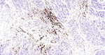 CD105 Antibody in Immunohistochemistry (Paraffin) (IHC (P))