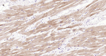 Cardiac Troponin I Antibody in Immunohistochemistry (Paraffin) (IHC (P))