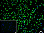 NF-L Recombinant Rabbit Monoclonal Antibody (3F2)