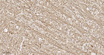NF-L Antibody in Immunohistochemistry (Paraffin) (IHC (P))