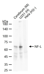 NF-L Antibody in Western Blot (WB)