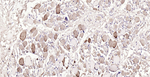 Myoglobin Antibody in Immunohistochemistry (Paraffin) (IHC (P))