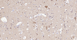 PGP9.5 Antibody in Immunohistochemistry (Paraffin) (IHC (P))