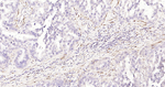 PGP9.5 Antibody in Immunohistochemistry (Paraffin) (IHC (P))