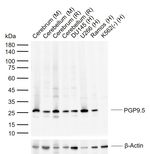 PGP9.5 Antibody in Western Blot (WB)