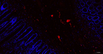 PGP9.5 Recombinant Rabbit Monoclonal Antibody (18C19)