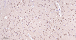 PGP9.5 Antibody in Immunohistochemistry (Paraffin) (IHC (P))