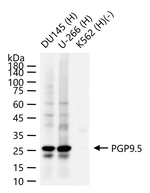 PGP9.5 Antibody in Western Blot (WB)