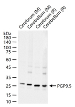 PGP9.5 Antibody in Western Blot (WB)