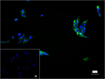 Procalcitonin Monoclonal Antibody (3E3)