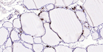 Procalcitonin Antibody in Immunohistochemistry (Paraffin) (IHC (P))