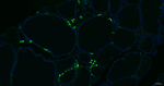 Procalcitonin Antibody in Immunohistochemistry (Paraffin) (IHC (P))