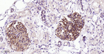 ZO-1 Antibody in Immunohistochemistry (Paraffin) (IHC (P))