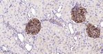 ZO-1 Antibody in Immunohistochemistry (Paraffin) (IHC (P))